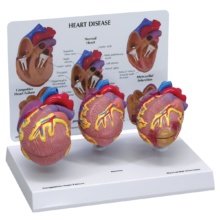 心臓疾患モデル