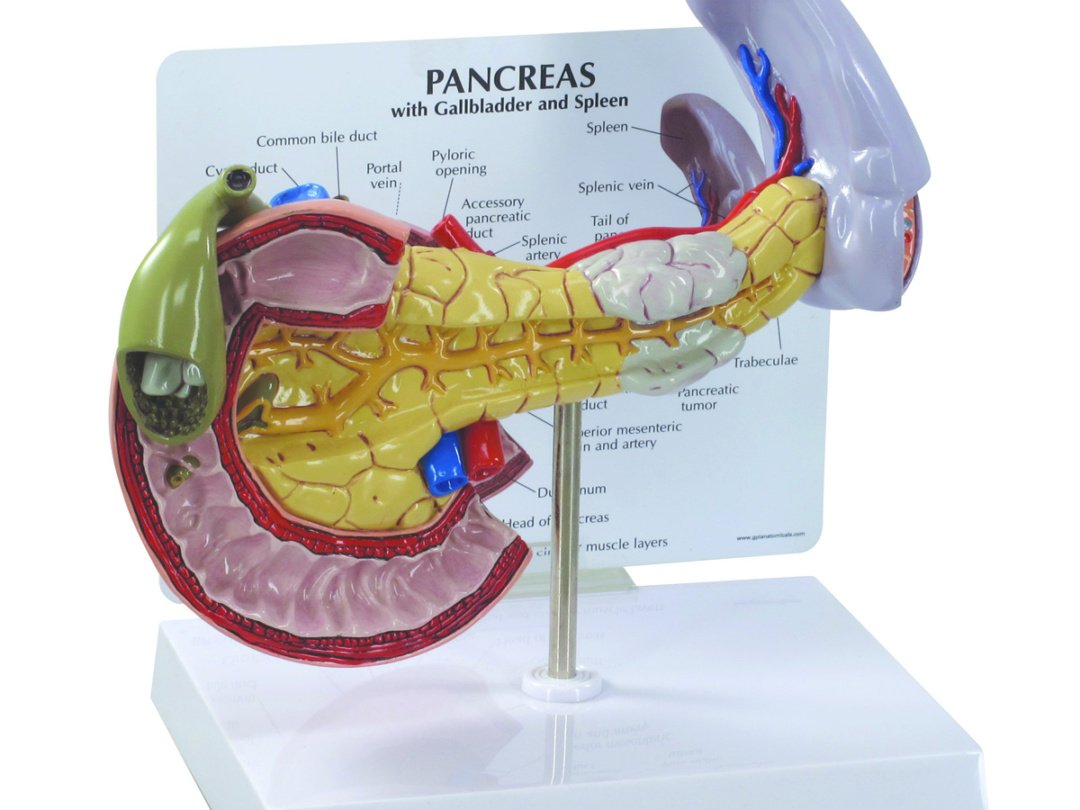 膵臓，胆嚢，脾臓疾患モデル | 日本スリービー・サイエンティフィック