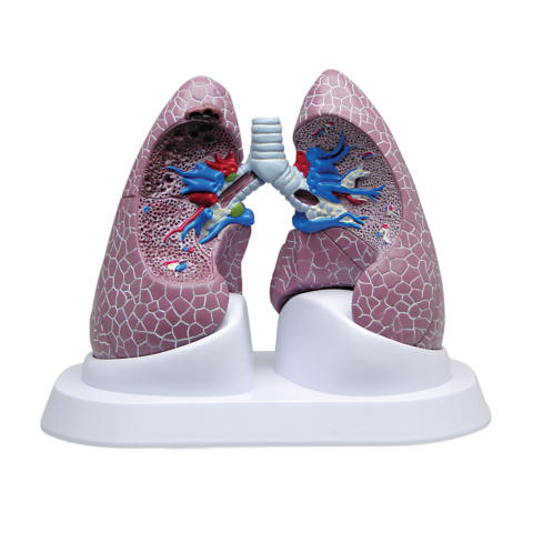 肺疾患モデル