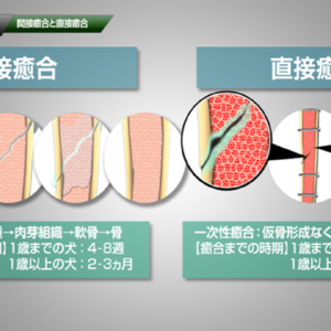 関節癒合と直接癒合