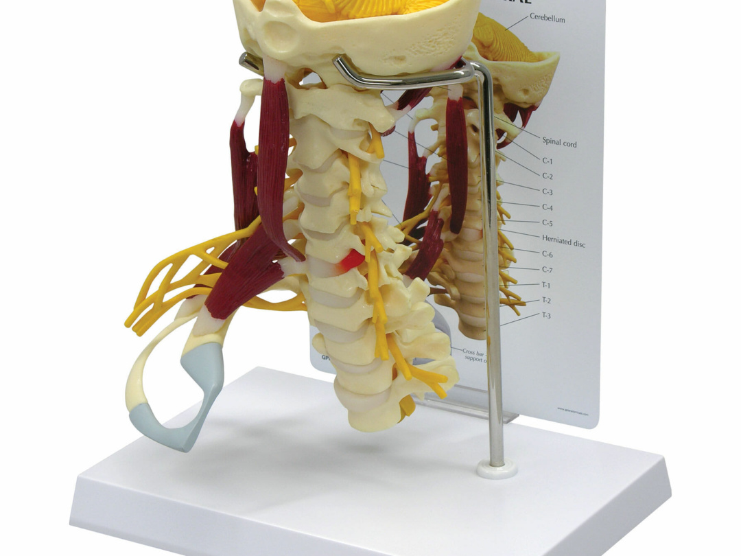筋付き頚椎モデル | 日本スリービー・サイエンティフィック