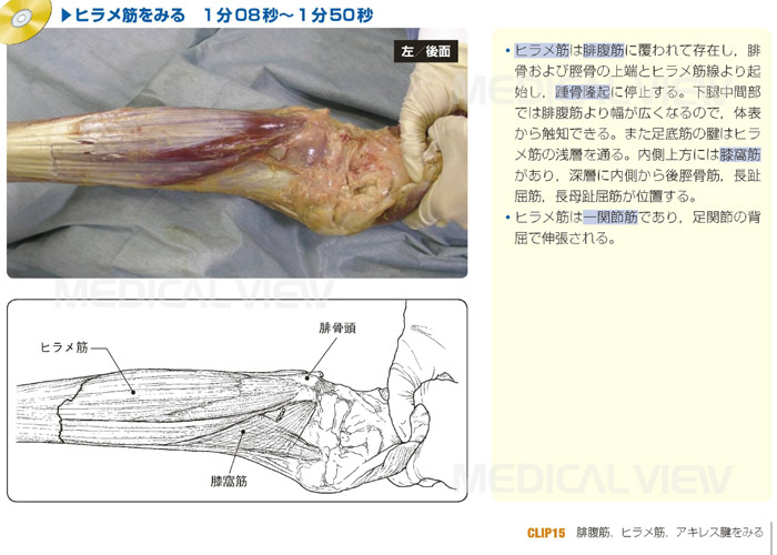 モーション解剖アトラス 下肢・骨盤 | 日本スリービー・サイエンティ