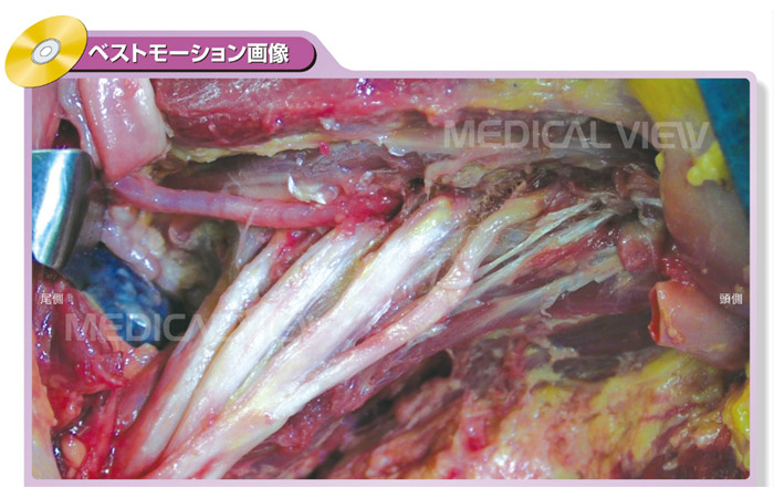 モーション解剖アトラス 脊椎 | 日本スリービー・サイエンティフィック