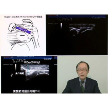 超音波検査入門 ＜肩・肘＞