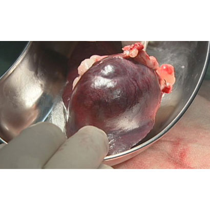 松田教授のよくわかる獣医外科基礎講座「イヌの脾臓全摘出術」