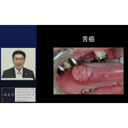 知っておきたい！「 口腔粘膜疾患 」