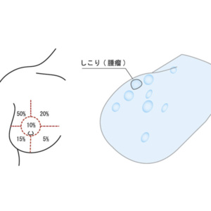 しこりは9つ埋め込まれています