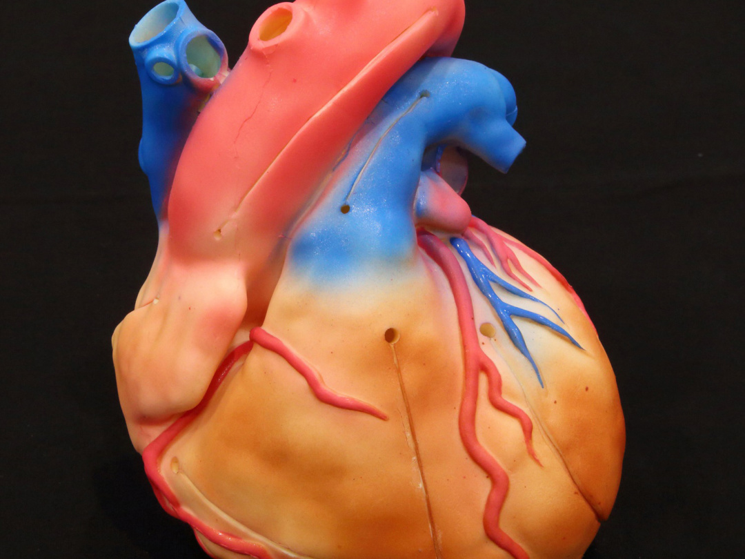 Cardio Model E.V. Color | 日本スリービー・サイエンティフィック