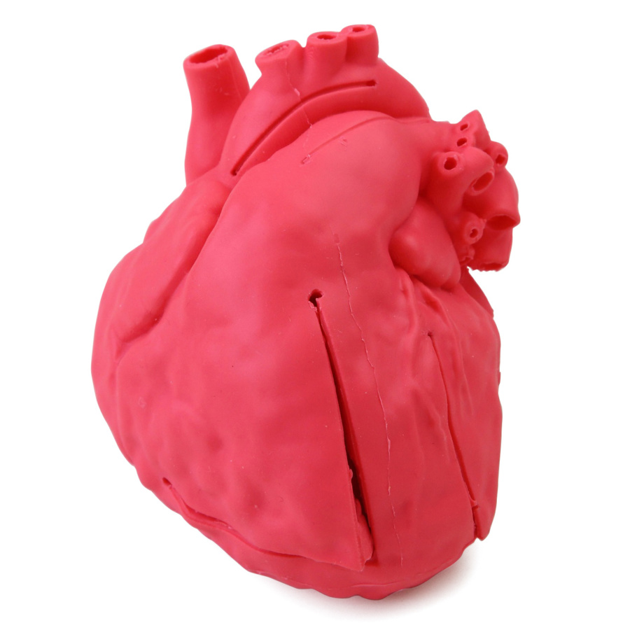 先天性小児心疾患モデル 心房中隔欠損（ASD) | 日本スリービー