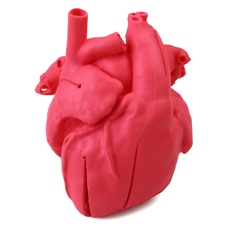 ベッドサイドの心臓病学(外箱劣化してます) 先天性小児心疾患モデル 修正大血管転位＋心室中隔欠損（VSD） | 日本