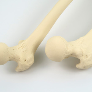 大腿骨