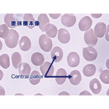 血液学検査