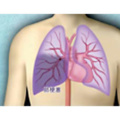 肺循環障害