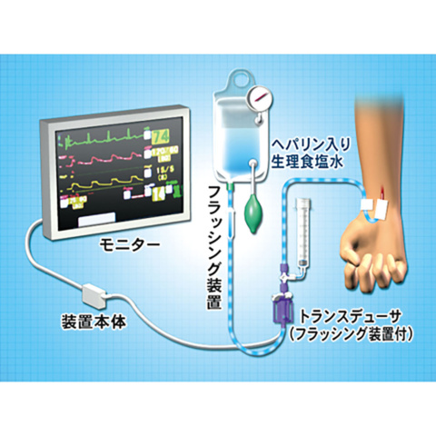 カテーテル は スワンガンツ と スワンガンツカテーテル看護管理①SGカテーテルがわかる！コレが管理ポイント