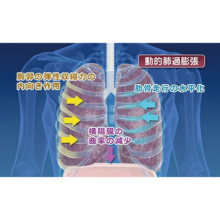 呼吸器のリハビリテーション