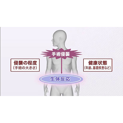 Vol.1 周術期看護の基礎知識