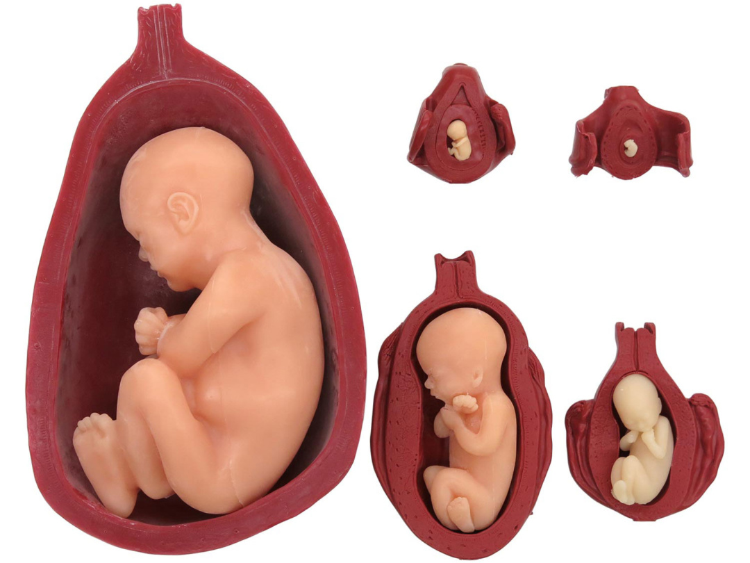 子宮と胎児，5段階セット，ソフトモデル | 日本スリービー・サイエンティフィック