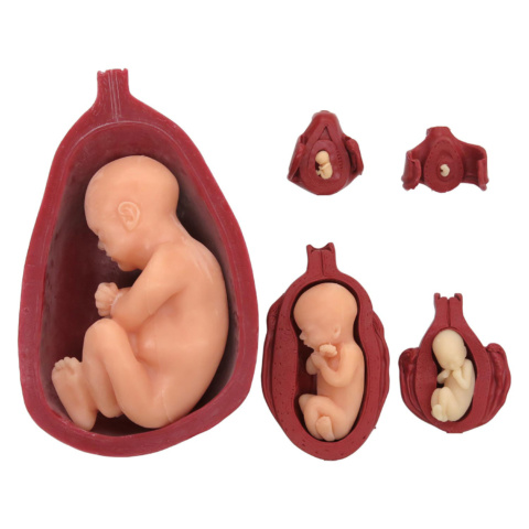 子宮と胎児，5段階セット，ソフトモデル